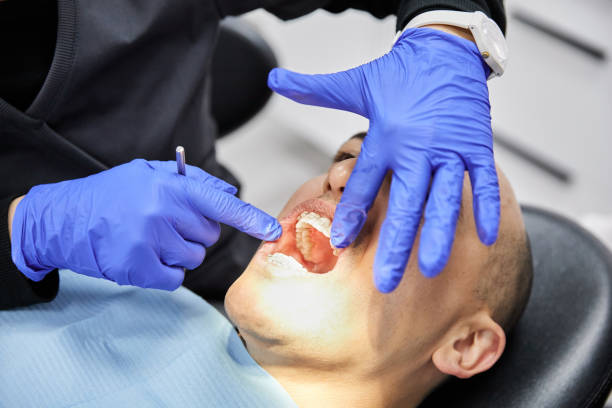 Best Dentist for Tooth Abscess  in Millport, AL
